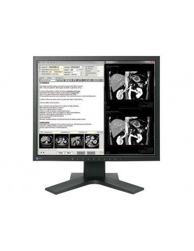 radiforce-med-clinical-review-color-1.jpg