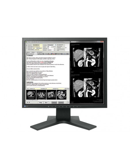 radiforce-med-clinical-review-color-1.jpg