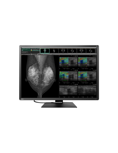radiforce-monitor-309-color-4200-x-2800-12mp-2.jpg