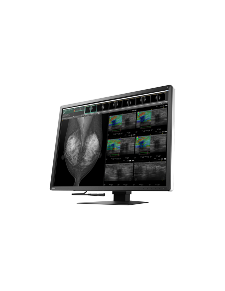 radiforce-monitor-309-color-4200-x-2800-12mp-3.jpg